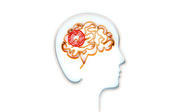 Praxis gains FDA Breakthrough Therapy Status for elsunersen for encephalopathy