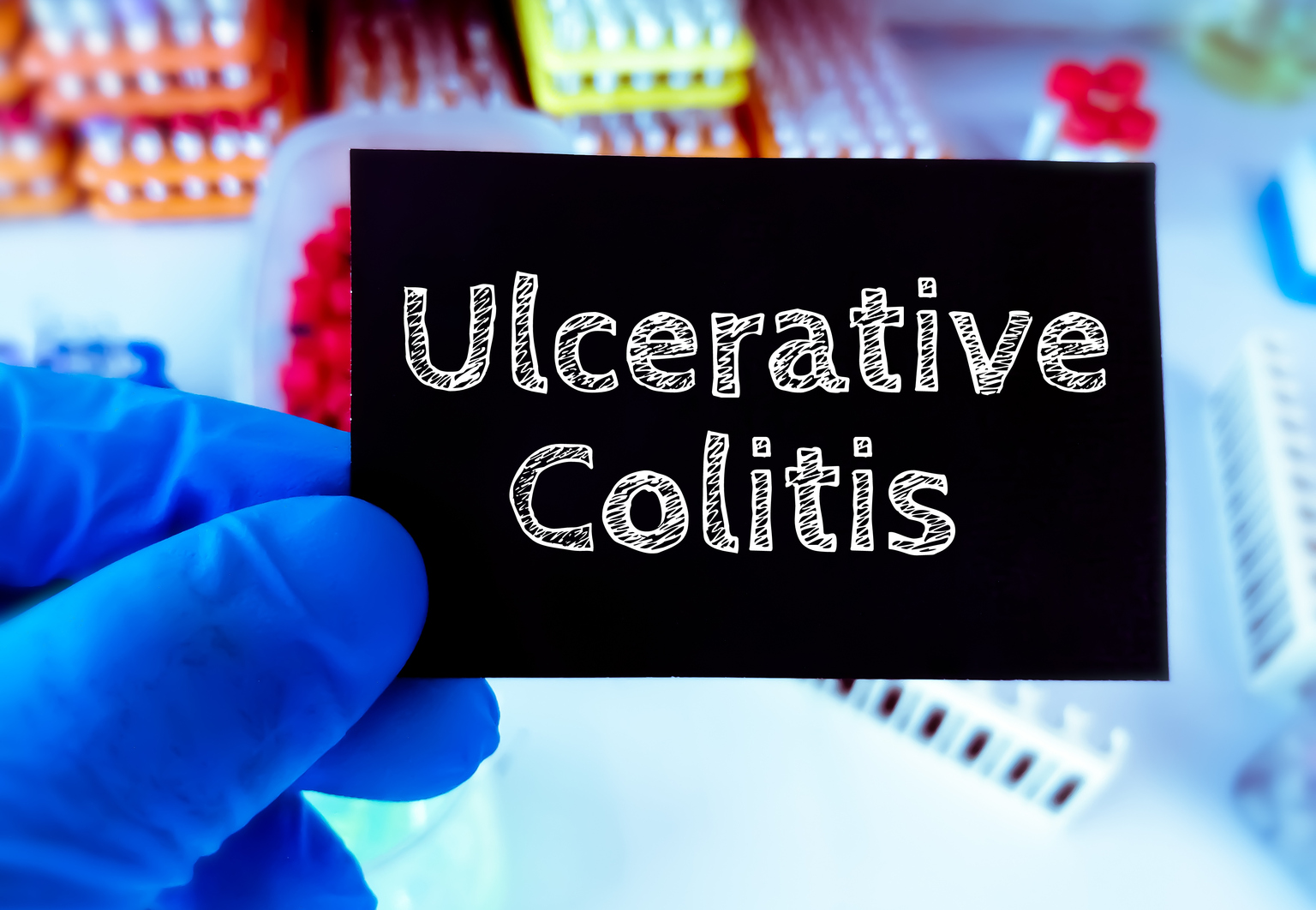 Ventyx Stock Plunges Following Phase 2 Results For Ulcerative Colitis   Image 1466543955 