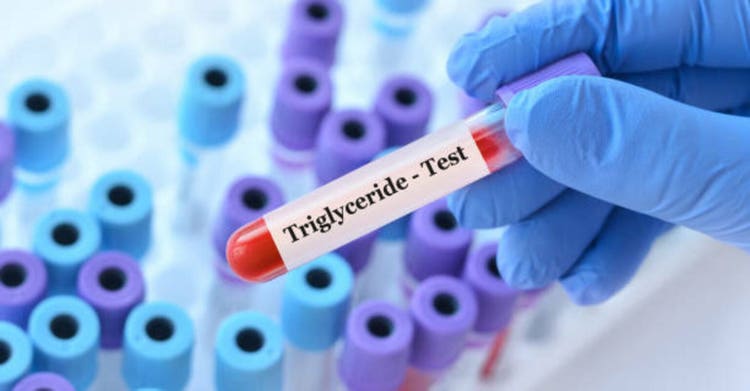 Doctor holding a test blood sample tube with Triglyceride test on the background of medical test tubes with analyzes