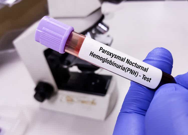 Blood sample for paroxysmal nocturnal hemoglobinuria (PNH) disease testing.  DRIED HAM