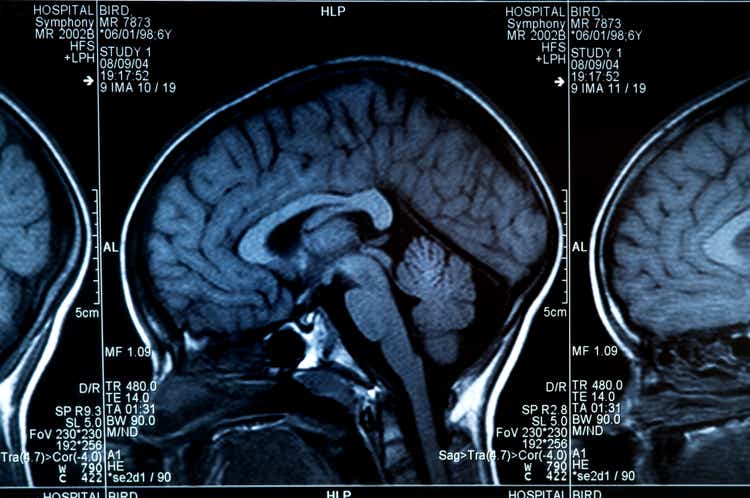 MRI scan of human brain and skull