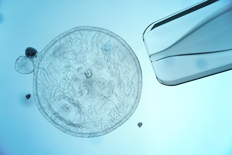 Stem Cell