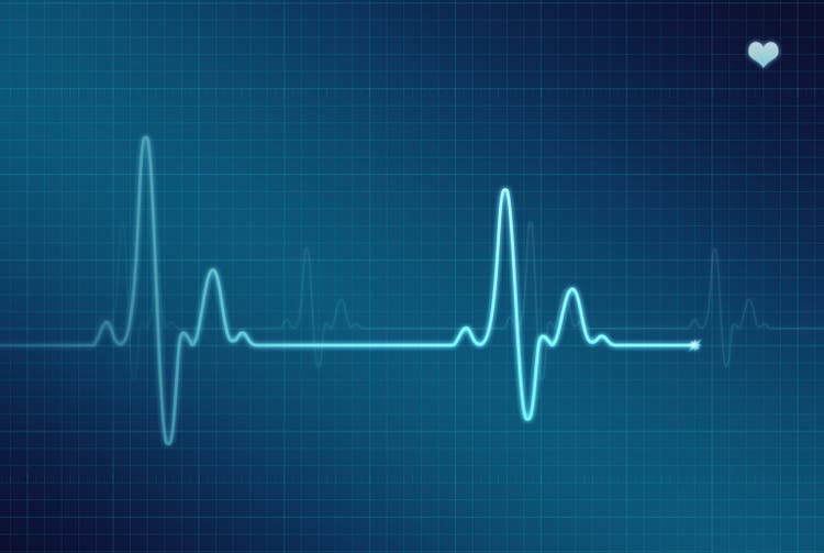 EKG - Electrocardiogram (XXL)