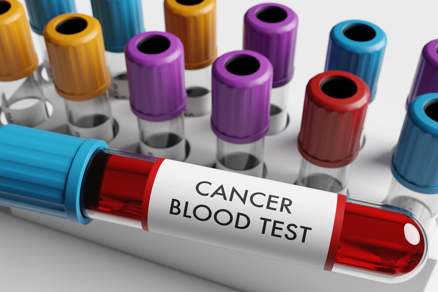 seekingalpha.com - Fundamental Options - Caris Life Sciences: Disrupting Cancer Screening And Therapy Selection (NASDAQ:CAI)