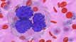 Bristol Myers' Breyanzi gains additional indication for follicular lymphoma article thumbnail