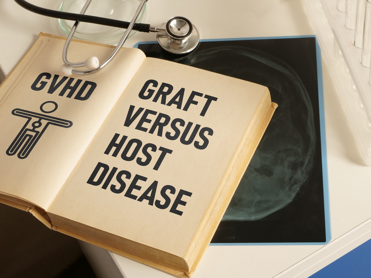 Mesoblast Graft Versus Host Disease Trial: Breakthrough Results Revealed 2 Mesoblast Graft Versus Host Disease Trial: Breakthrough Results Revealed