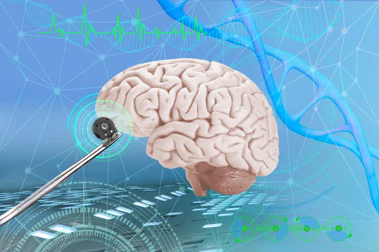 Electronic chip, bug in scientist"s hand, Successful implantation of wireless chip into human brain, Cybernetics and Human Enhancement, Future of Brain-Computer Interfaces