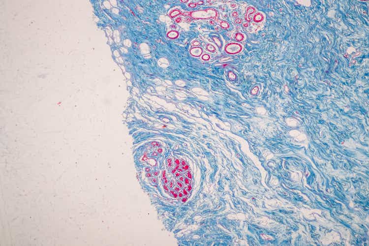 Mammary Human under the microscope in Lab.