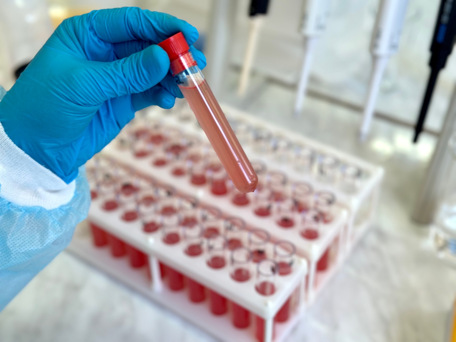 Taysha: Initial Rett Syndrome Data Leads To Other 2024 Catalysts (NASDAQ:TSHA) Taysha: Initial Rett Syndrome Data Leads To Other 2024 Catalysts (NASDAQ:TSHA)
