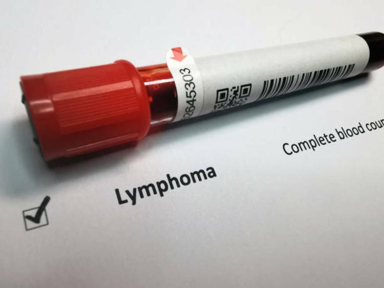 Lymphoma blood test