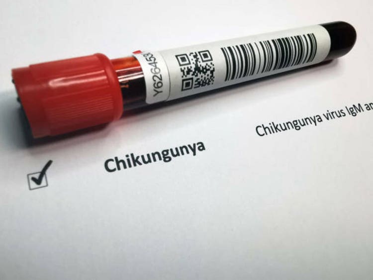 Chikungunya virus IgM antibodies test