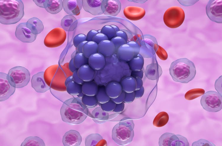 Schrödinger stock slides on cancer trial data (SDGR:NASDAQ)