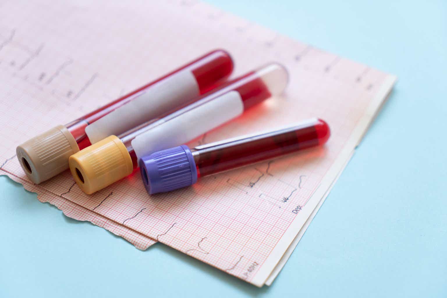 Quest Diagnostics: A Leader But Waiting For Better Price