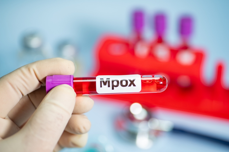 Blood collection tubes Mpox test positive results,WHO to rename monkeypox as ‘Mpox’