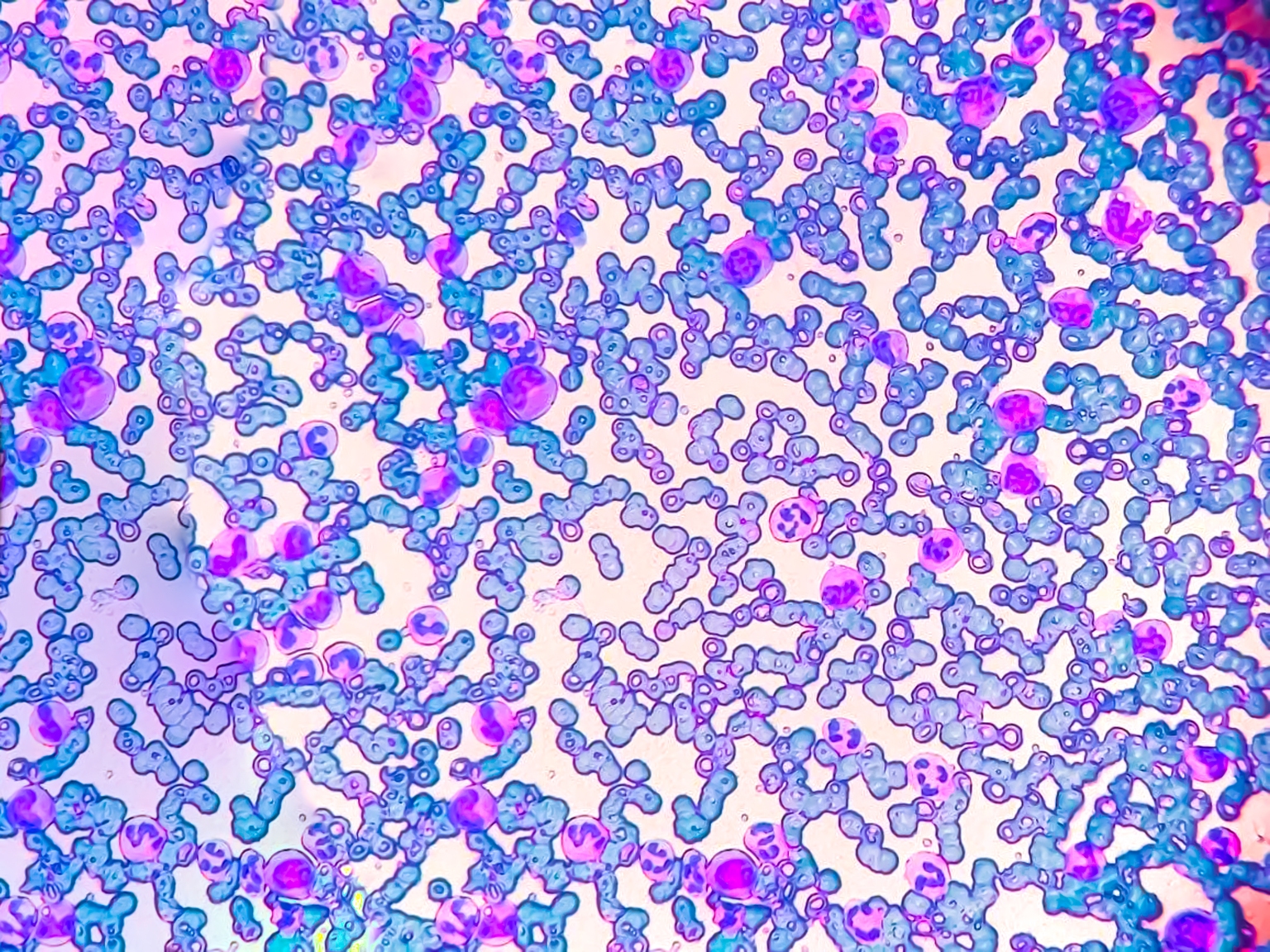 Bristol Myers Squibb Stock: A Pharma Giant Trading Like Growth Is Over - It's Not (BMY)