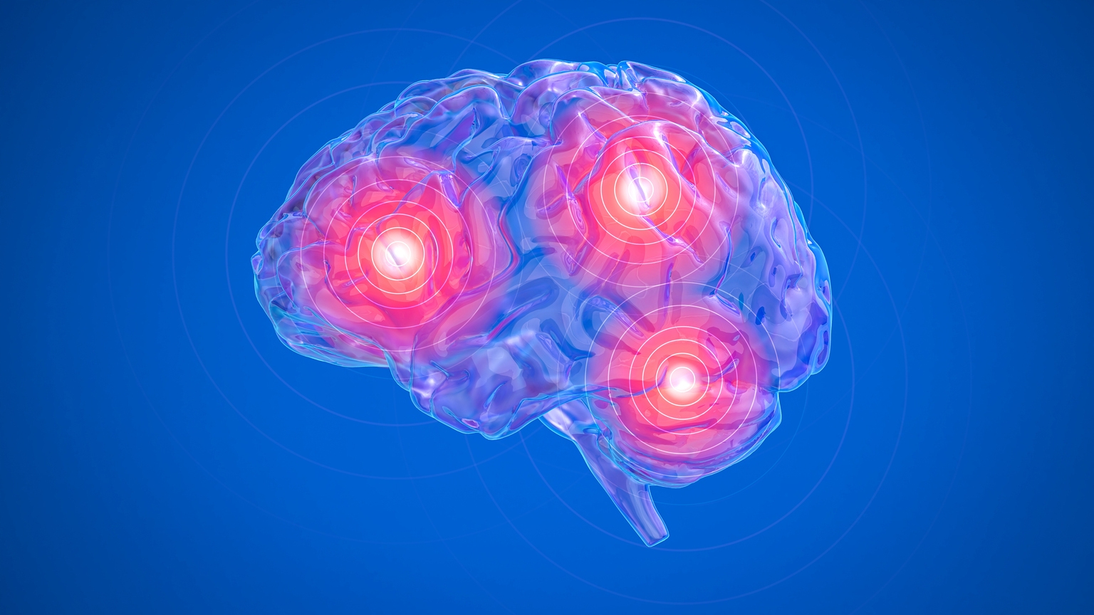ClearPoint Neuro : l’installation CRO devrait réaccélérer sa croissance (NASDAQ : CLPT)