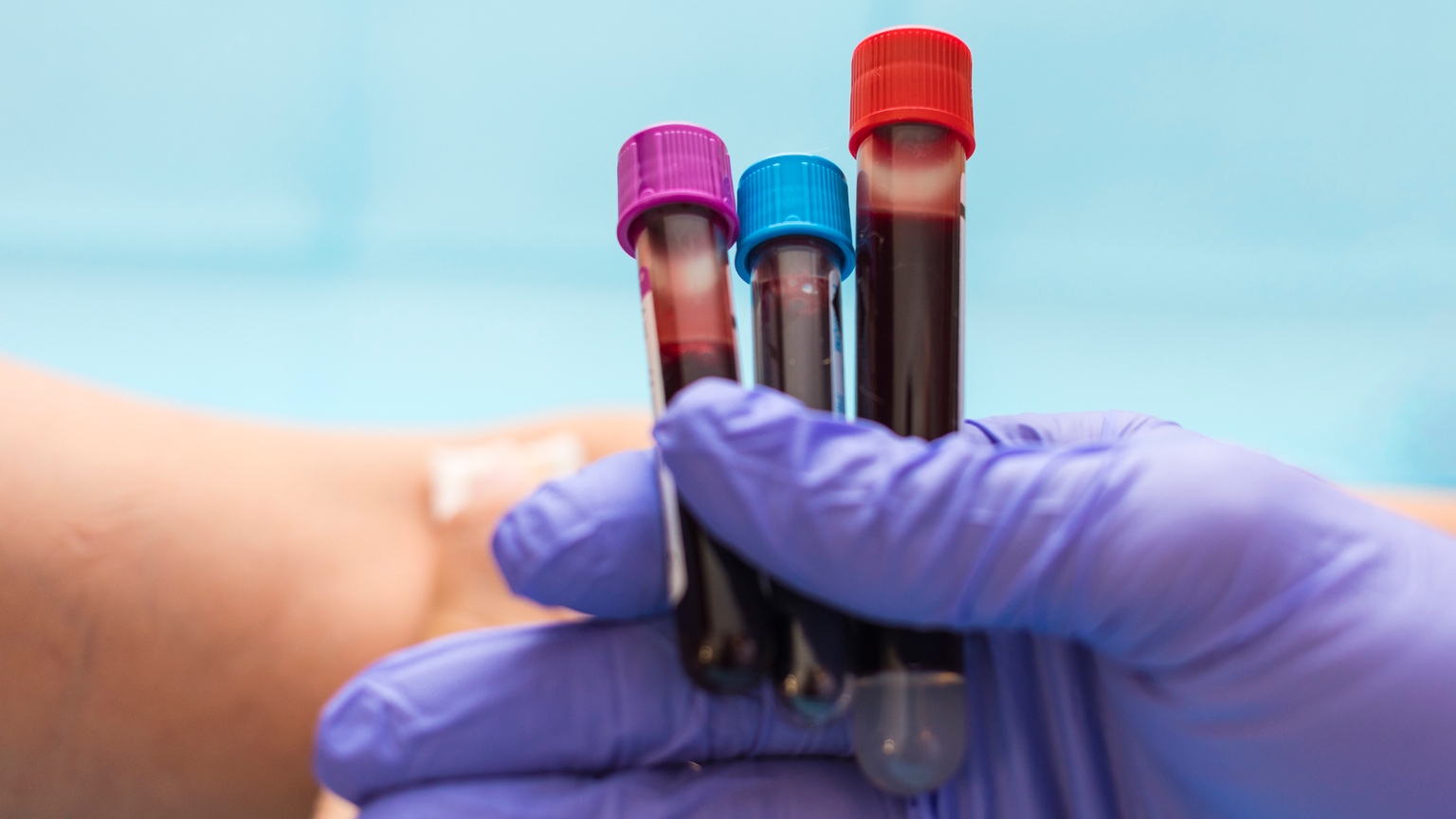 Guardant Health Stock: An Expensive Price For A Great Company (NASDAQ:GH) Guardant Health Stock: An Expensive Price For A Great Company (NASDAQ:GH)
