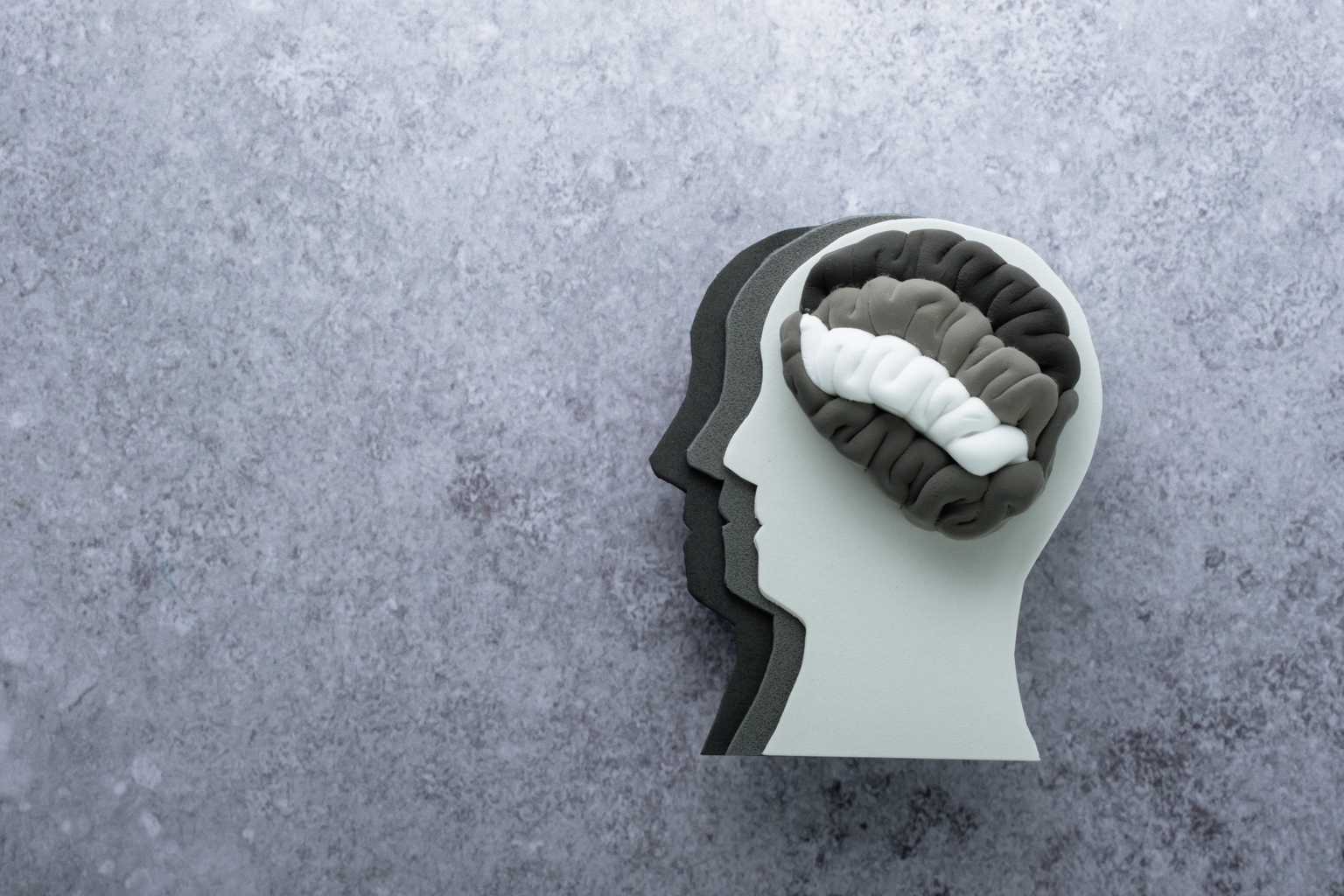 Reviva Pharmaceuticals: Brilaroxazine Seems Efficacious, But Progress Is Slow And Dilution Is High