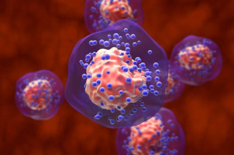 Triple-negative breast cancer (TNBC) - closeup view 3d illustration