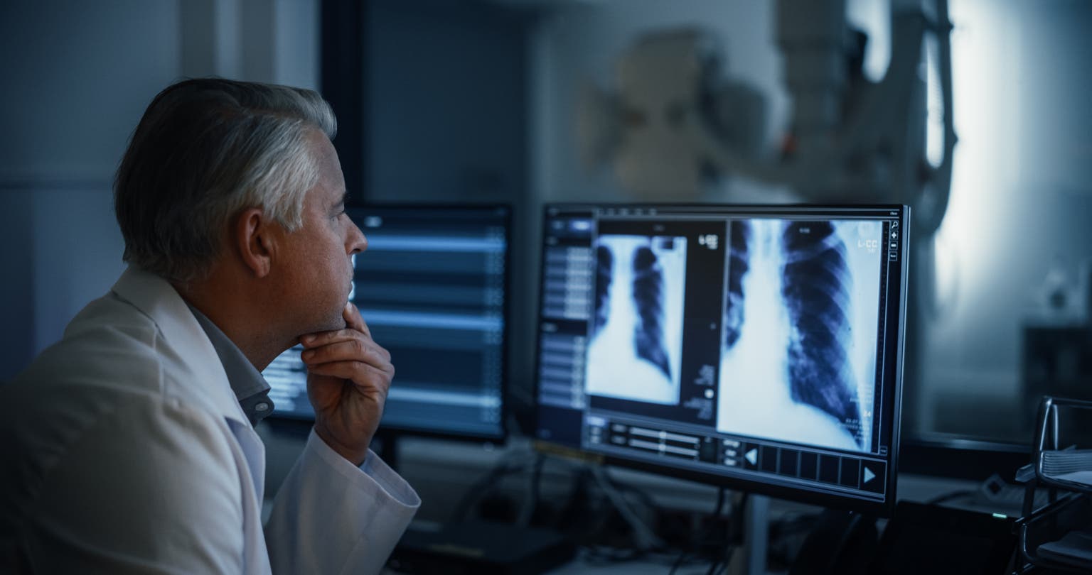 iCAD Merger Arbitrage: Low-Risk Returns From A Game-Changing AI Imaging Acquisition