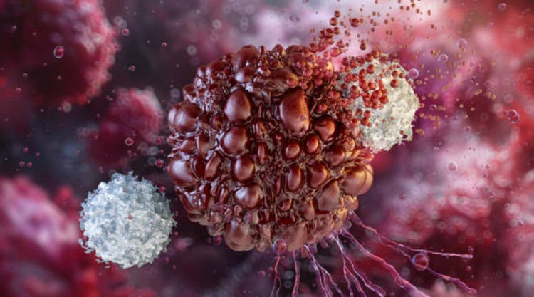 Nurix stock drops on new trial data for lead drug (NRIX:NASDAQ)