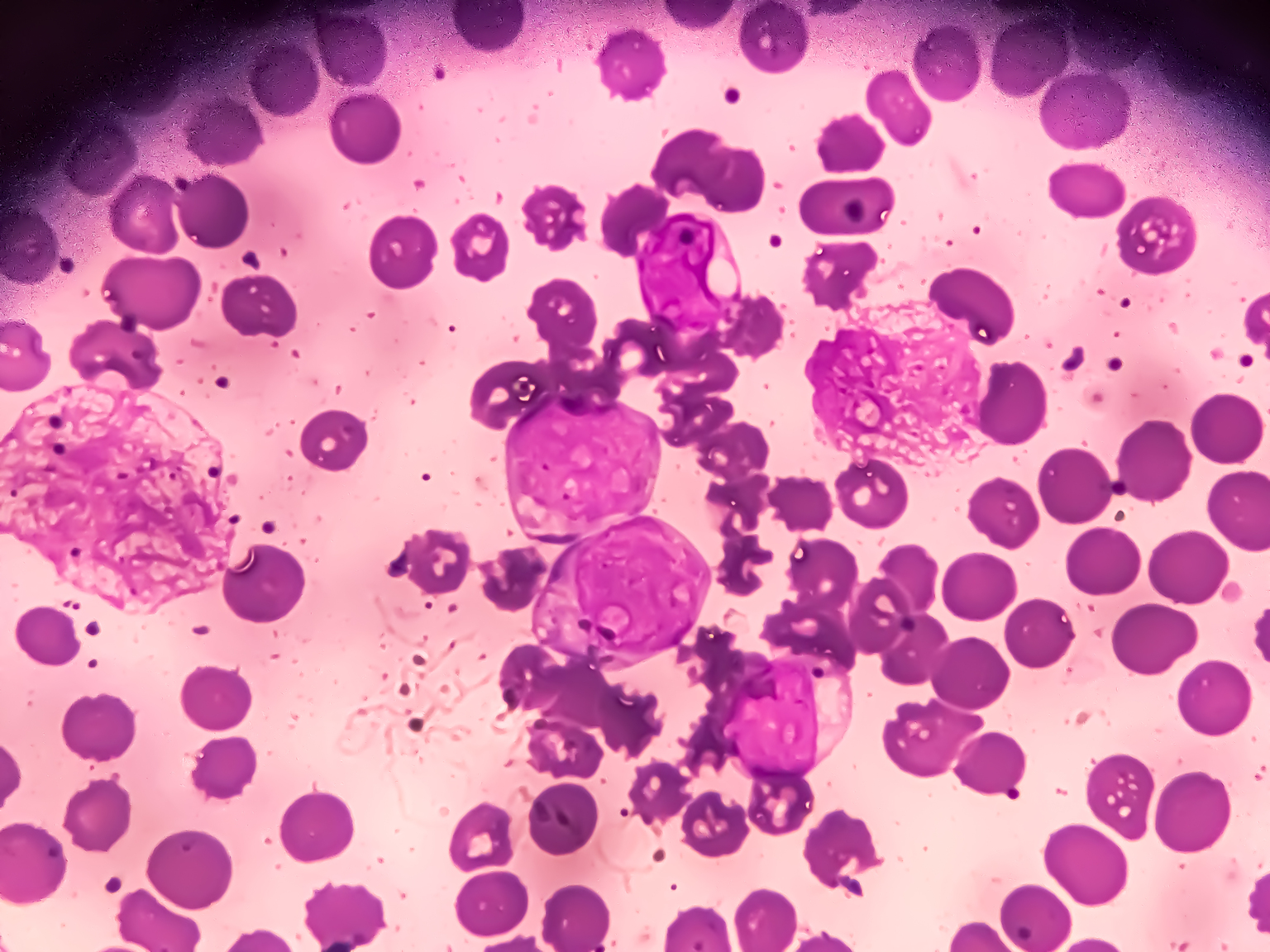 seekingalpha.com - Brendan O'Boyle - Syndax Pharma: Continuing Execution In AML (NASDAQ:SNDX)