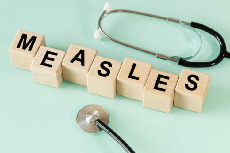 Measles disease. Health concept, Infectious, viral diseases. Vaccination of children against measles. close up