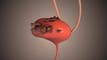 UroGen closes up 43% ahead of FDA decision on bladder cancer candidate article thumbnail