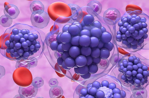Diffuse large B-cell lymphoma (DLBCL) - semicloseup view 3d illustration