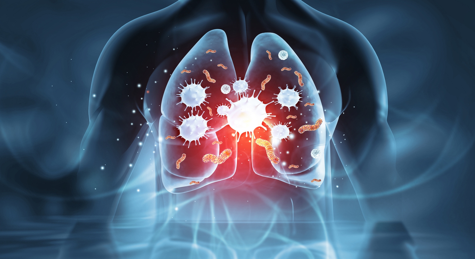 Insmed: “Strong Buy” As Possible Label Expansion For ARIKAYCE Bodes Well (NASDAQ:INSM)