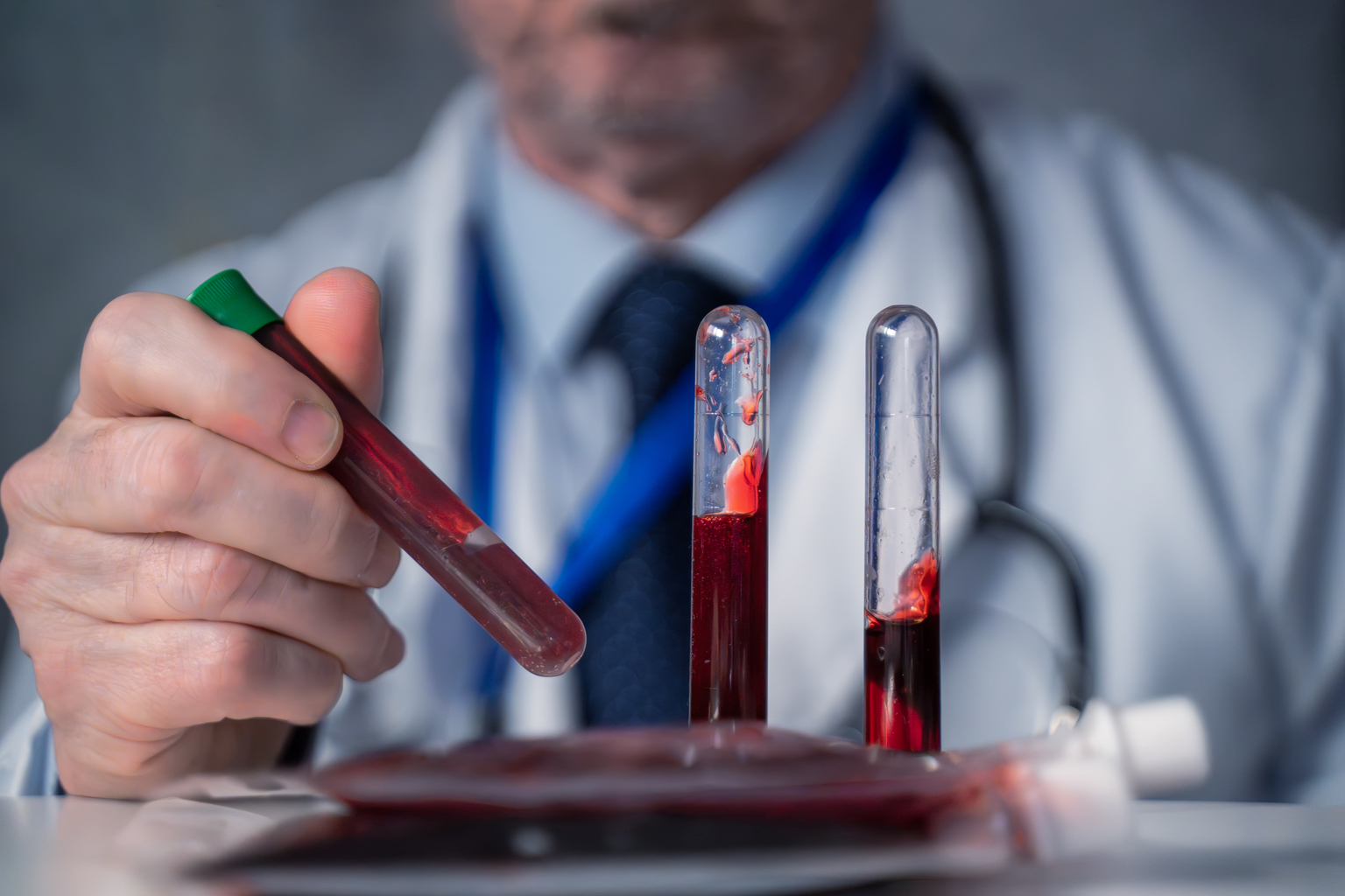 seekingalpha.com - Caffital Research - GRAIL Stock: FDA Approval Could Unlock Vast Potential (NASDAQ:GRAL)