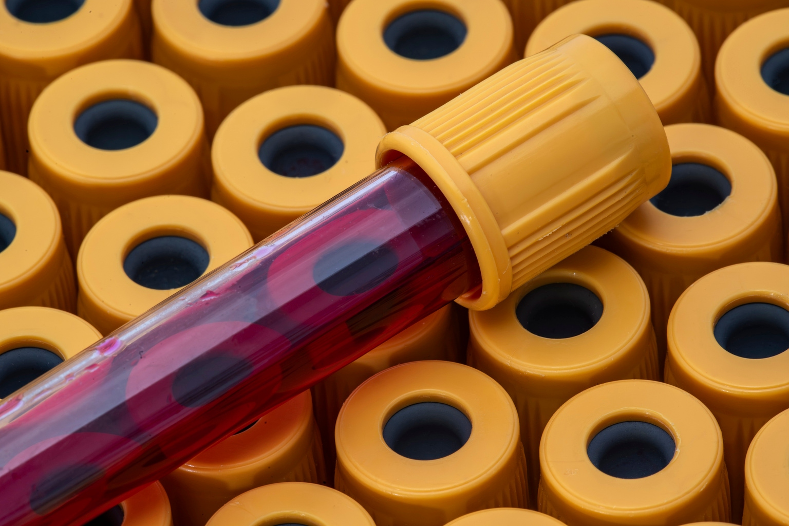 AnaptysBio: 'Hold' As Spin-Off Shifts Pipeline To First Tracks Biotherapeutics (ANAB)