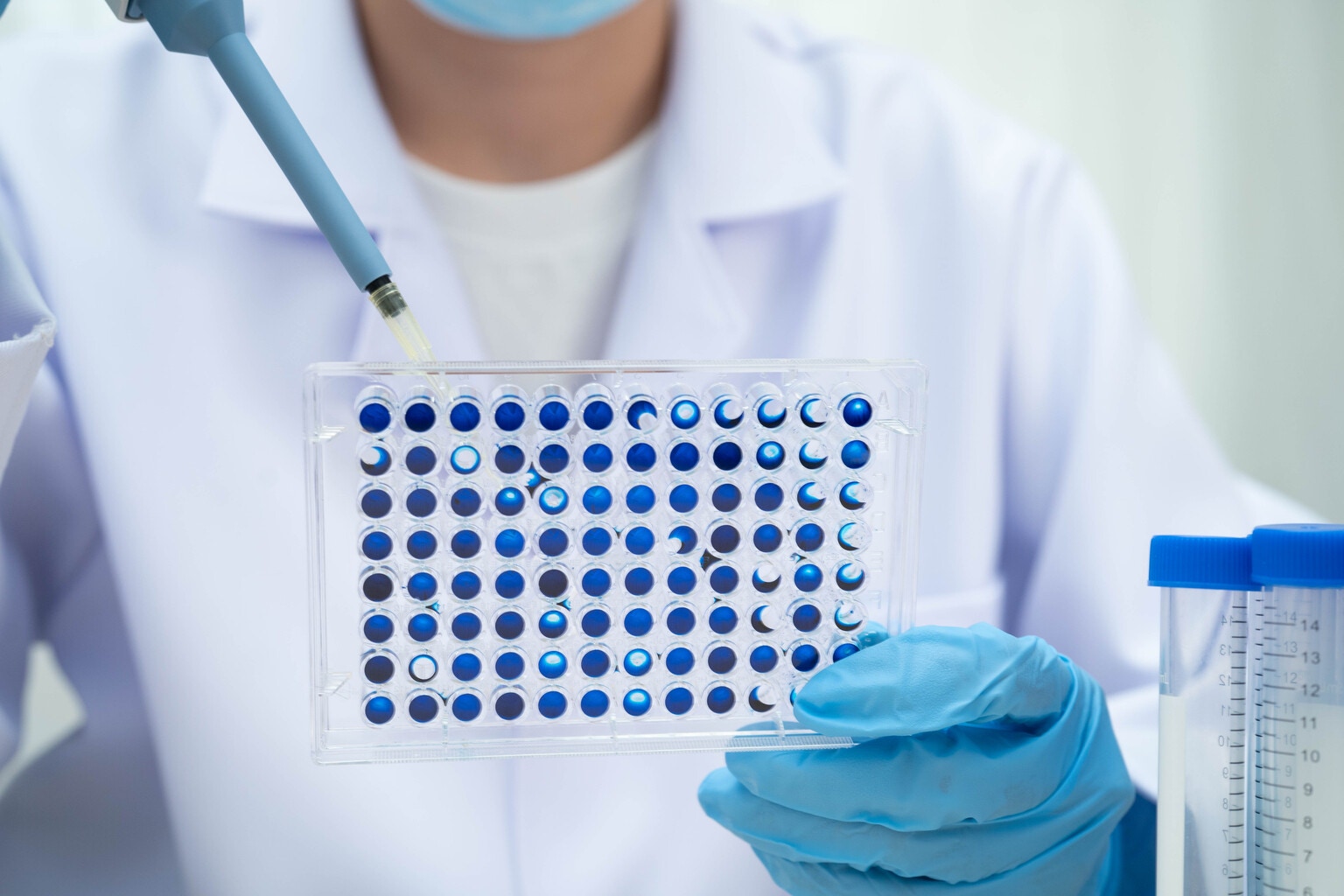 4D Molecular: Reiterate 'Buy' With Wet AMD 4D-150 Program On Track And Phase 3 DME Trial Underway