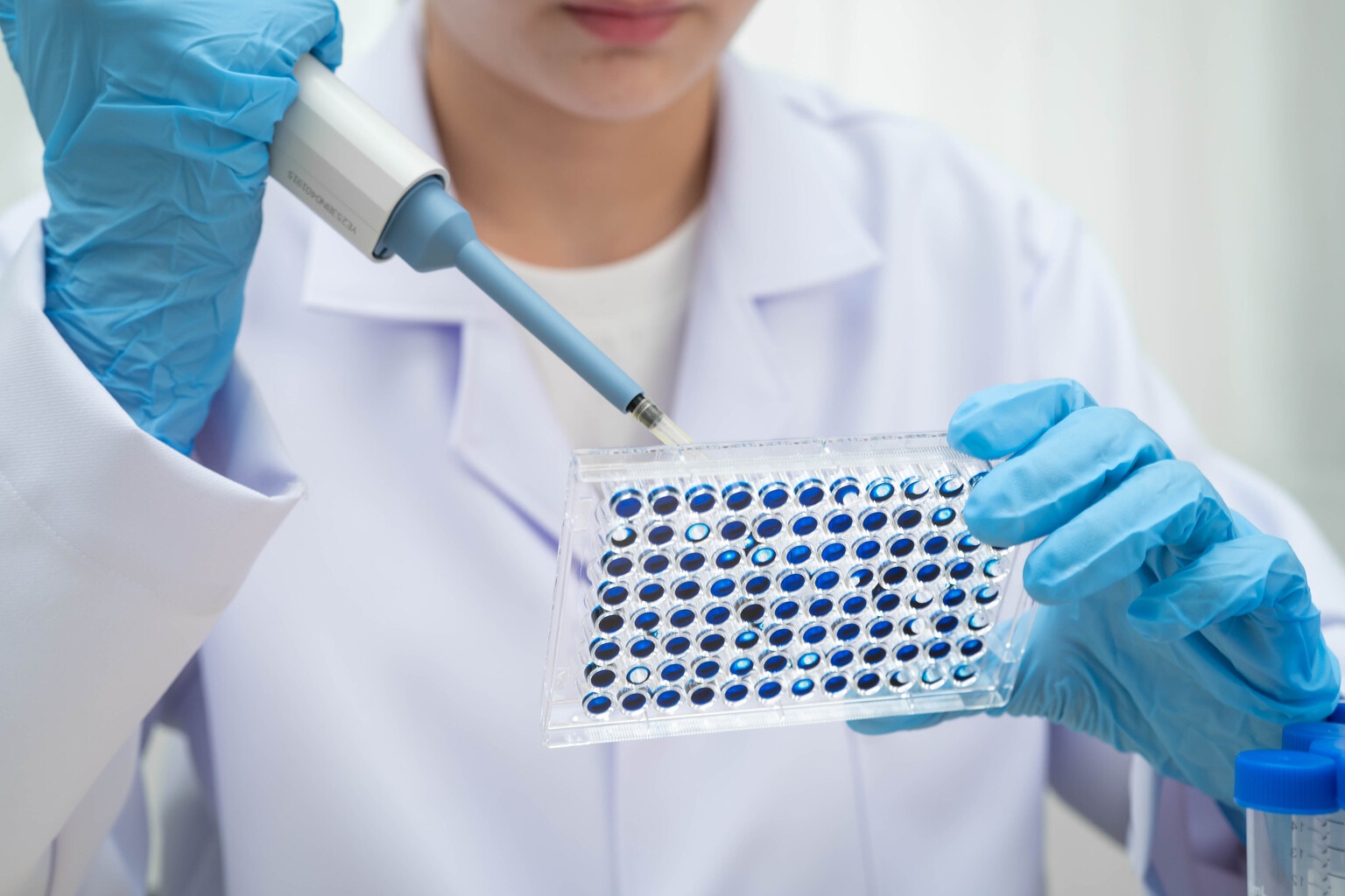 Voyager: Maintaining A Strong Buy For Q4 PET Imaging Data AD And More (NASDAQ:VYGR)