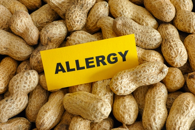 Peanut allergy