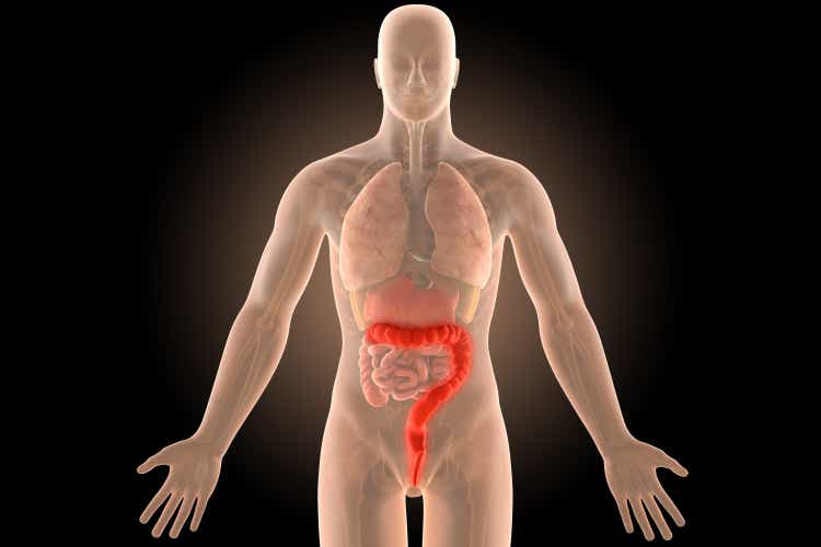 3d ulcerative extensive colitis infection with clipping path.
