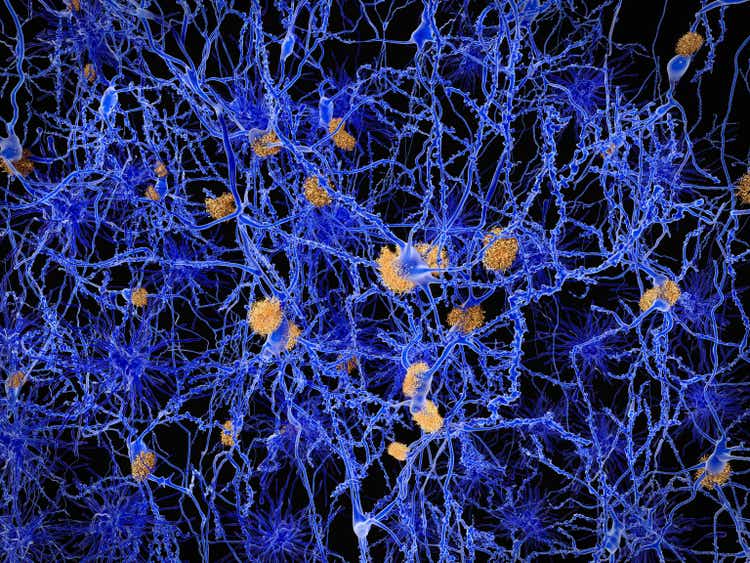 Alzheimer disease, neuron network with amyloid plaques