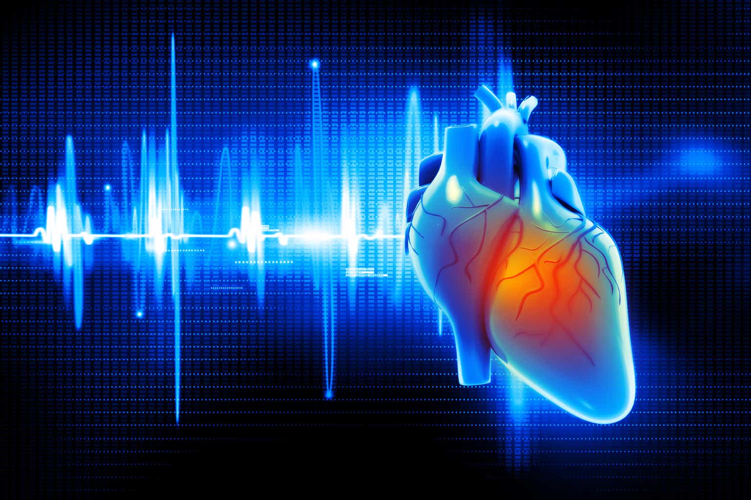 Cardiol Therapeutics: the first active in CBD-based treatment for heart disease