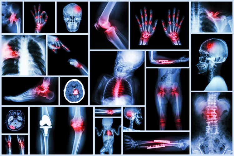 X-ray multiple human"s organ & orthopedic surgery & Multiple disease