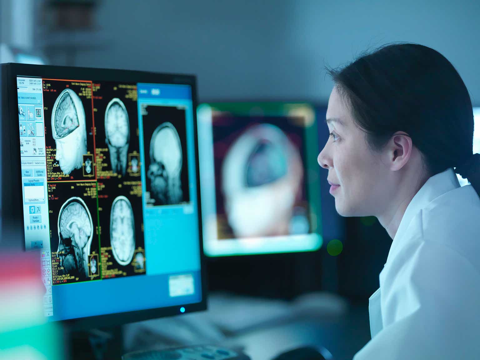 GE Healthcare Light Up With Growth Indicators In Medical Tech, While Undervalued (GEHC) GE Healthcare Light Up With Growth Indicators In Medical Tech, While Undervalued (GEHC)