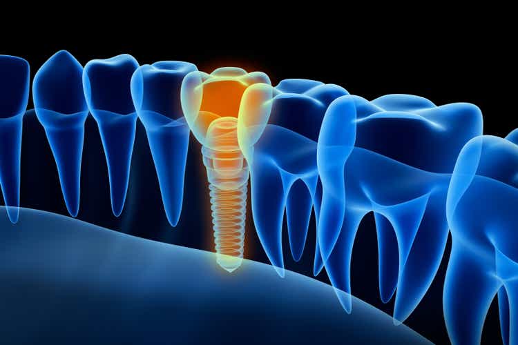 X-ray view of denture with implant. Xray view.