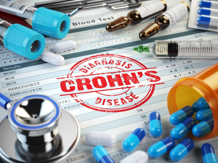 J&J Phase 3 study shows subcutaneous Tremfya effective in Crohn's