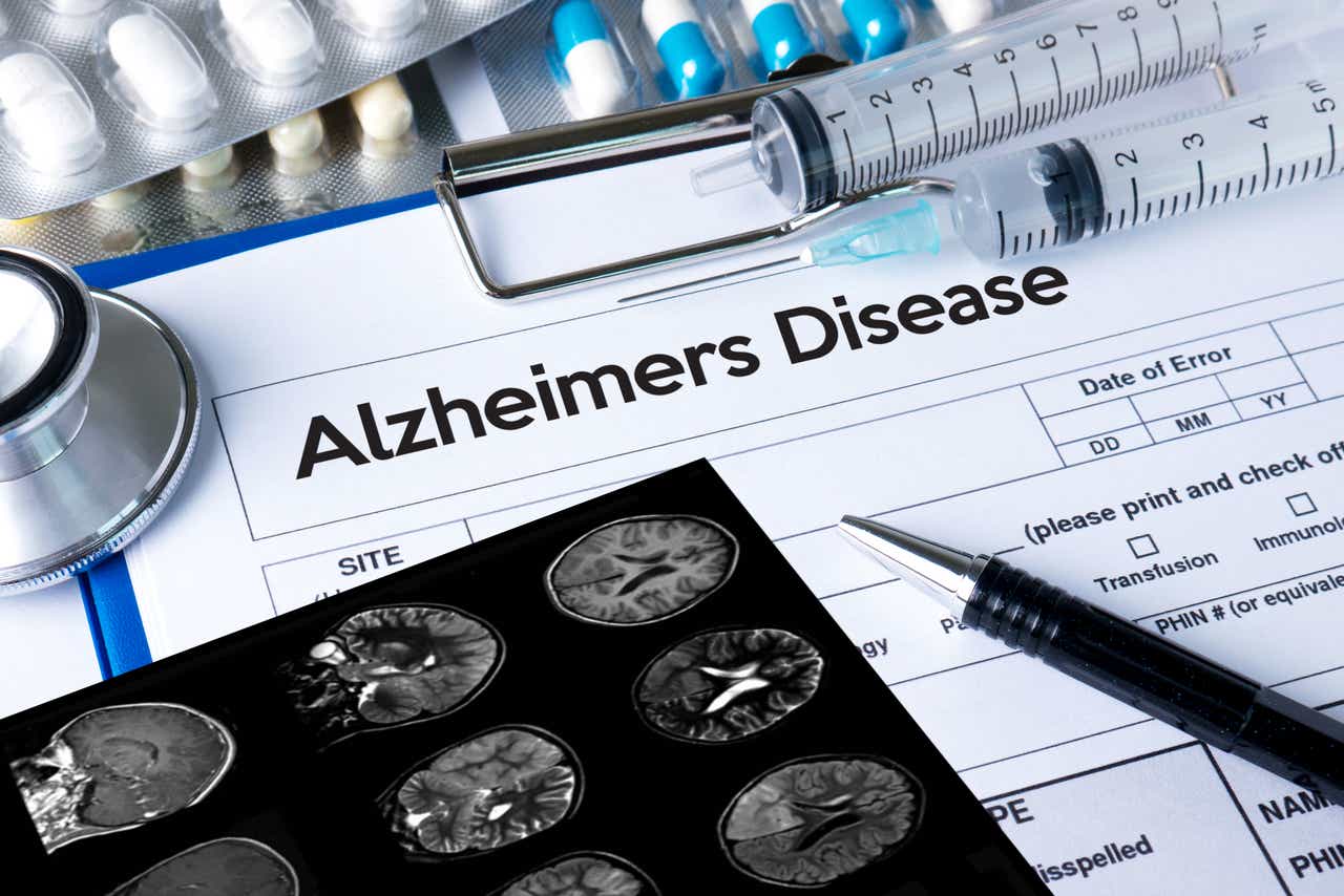 alzheimer's research news