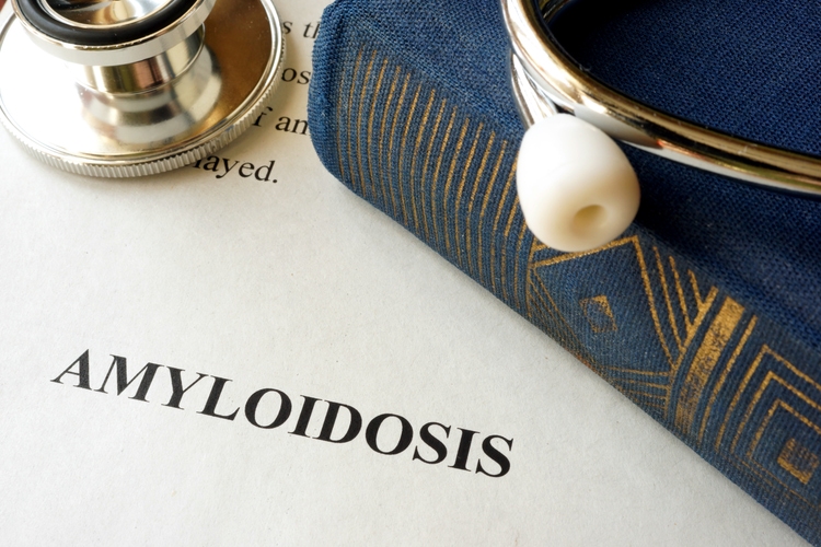 Document with diagnosis amyloidosis in a hospital.