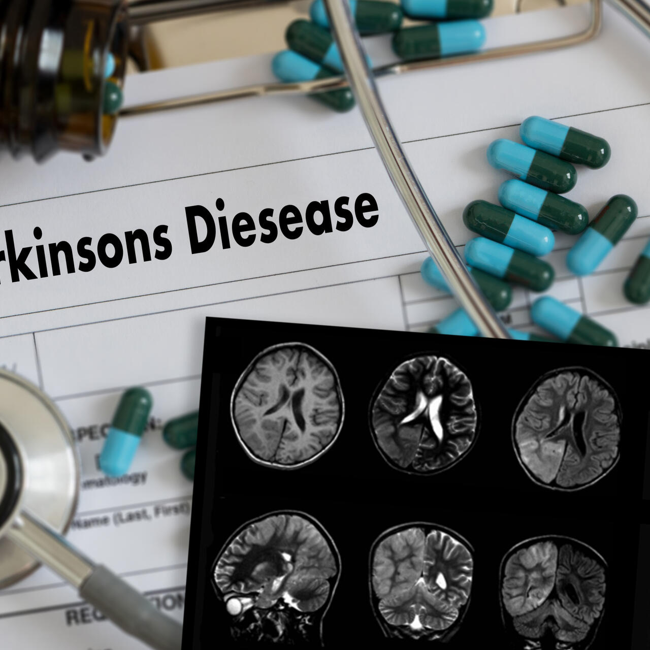 Vaxxinity Doses First Parkinson’s Disease Patient In Part B Of Early ...