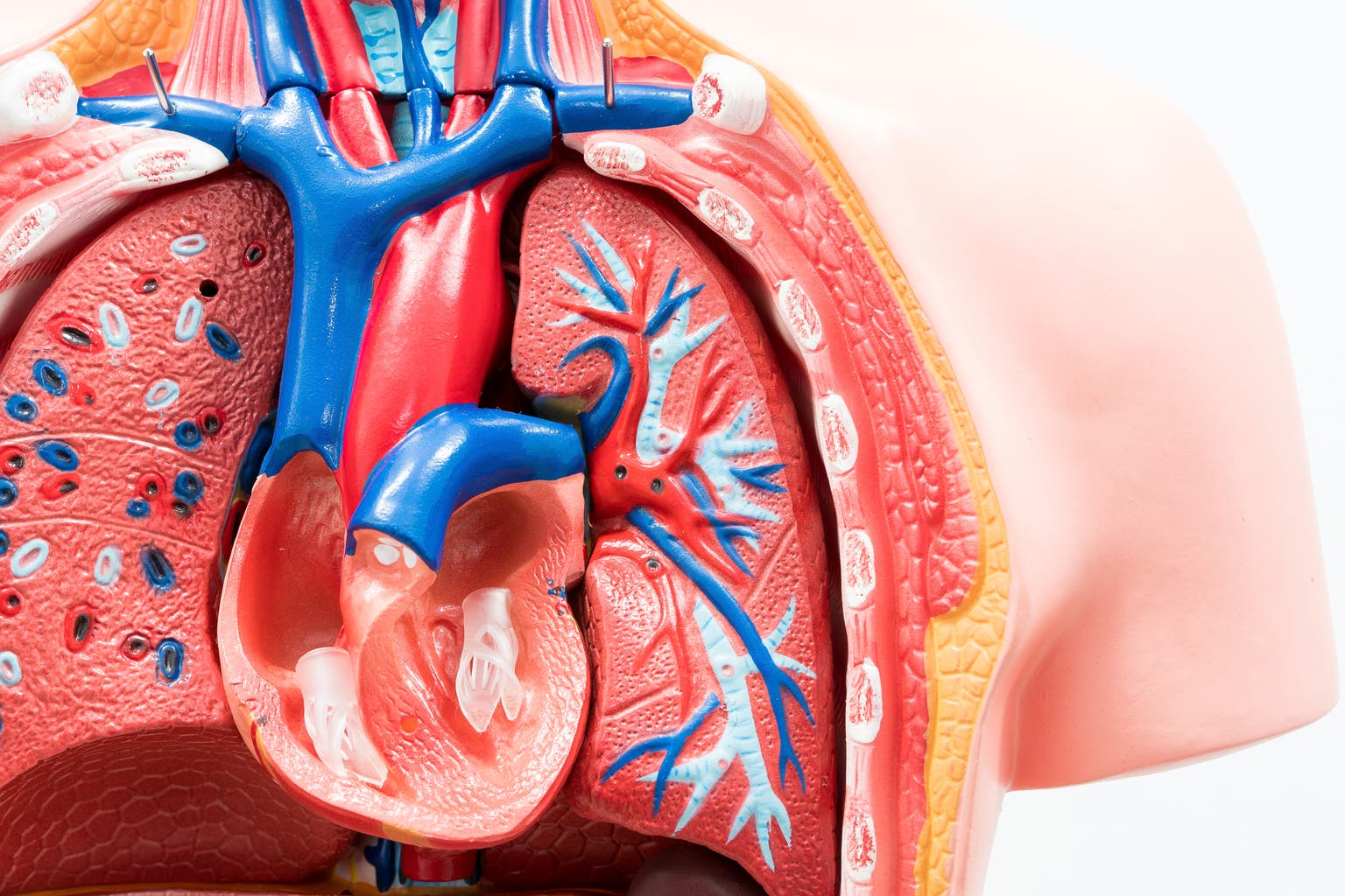 Edwards Lifesciences: Overbought Given Current Growth Prospects