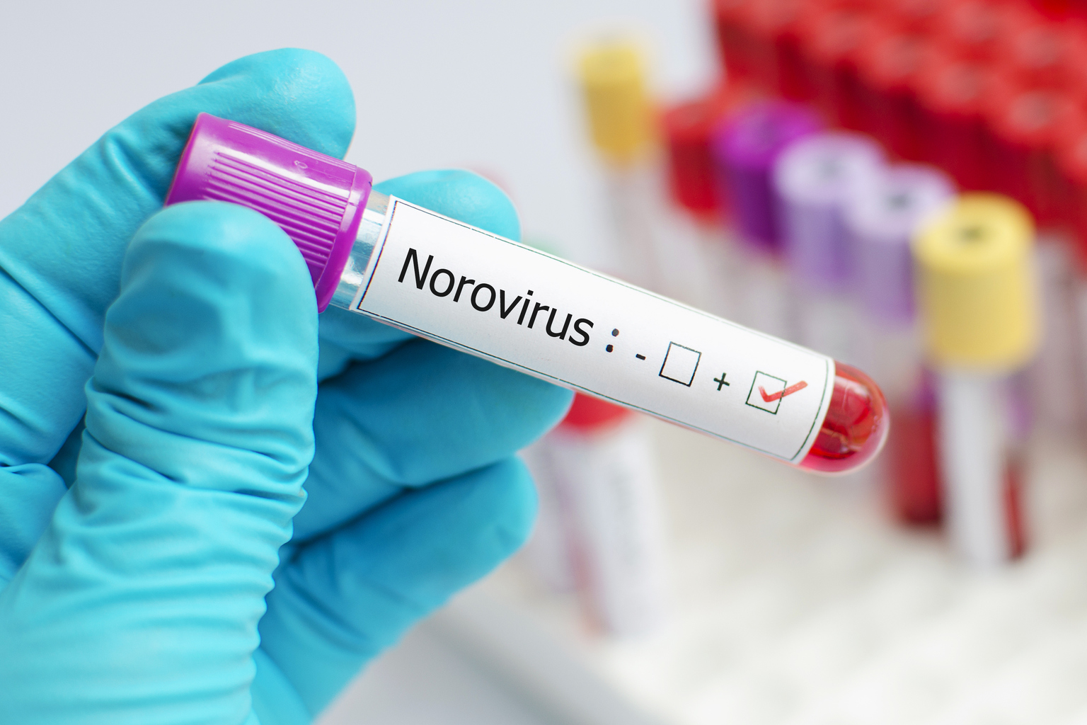 Vaxart Early Stage Trial Shows Immune Response Of Norovirus Vaccine   Image 916183788 