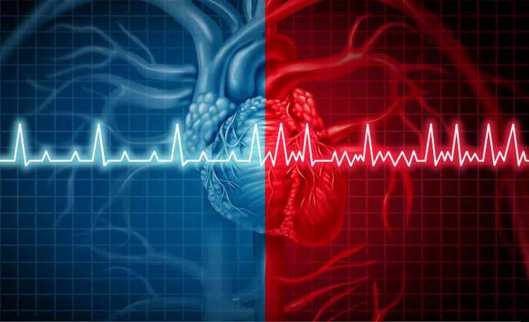 Atrial Fibrillation