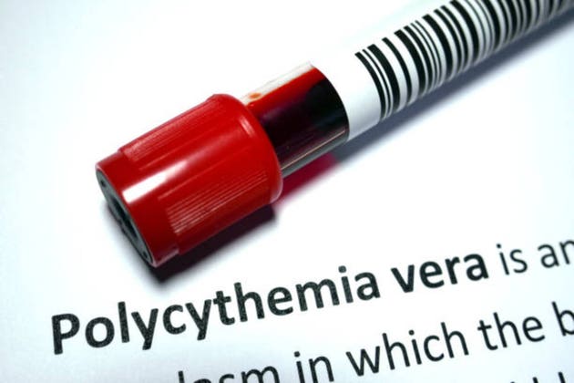 primary polycythemia