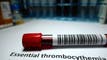 Incyte rises as it will present new data on thrombocythemia asset at conference article thumbnail